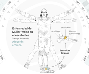 lesiones Nadal