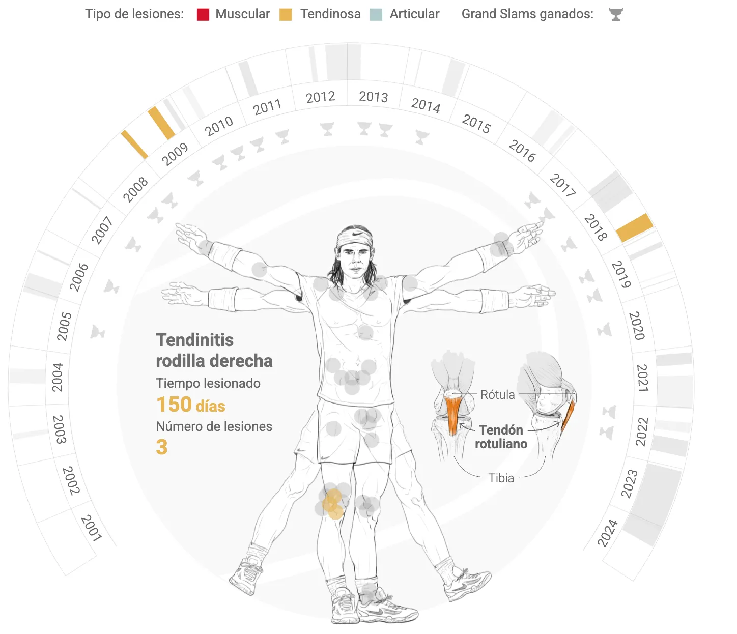 Rafa Nadal's Injuries